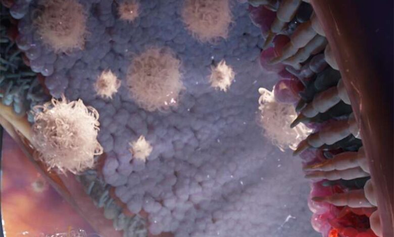 درمان نابینایی با ژن درمانی و فناوری نانو درمان نابینایی با ژن درمانی